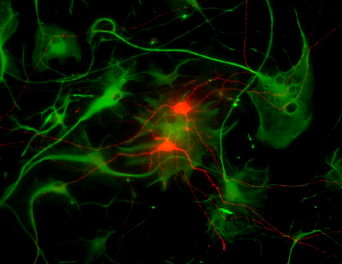 meyer-astrocytes.jpg